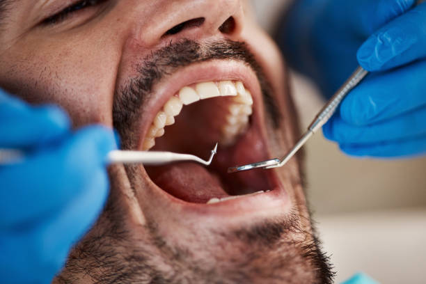 Best Wisdom Tooth Removal  in Curtisville, PA